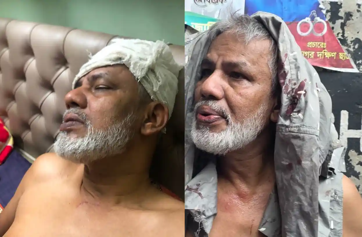চিত্র সাংবাদিক হাবিবের ওপর বর্বরোচিত হামলা: দায়ীদের গ্রেপ্তারে ডিইউজের আলটিমেটাম